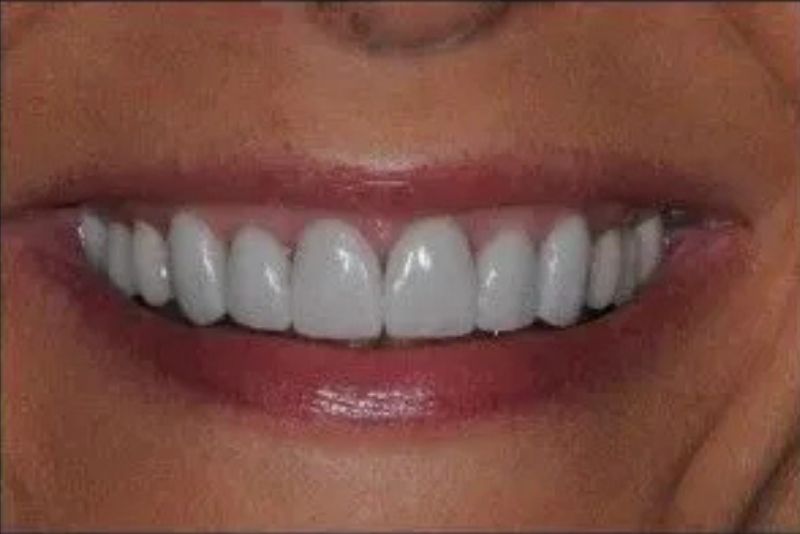 Before Afters
