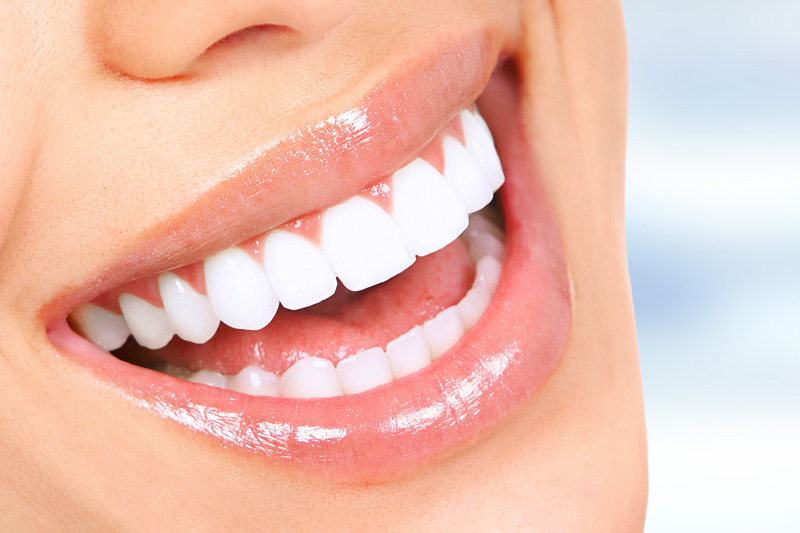 Cosmetic Dentistry in Clarkston