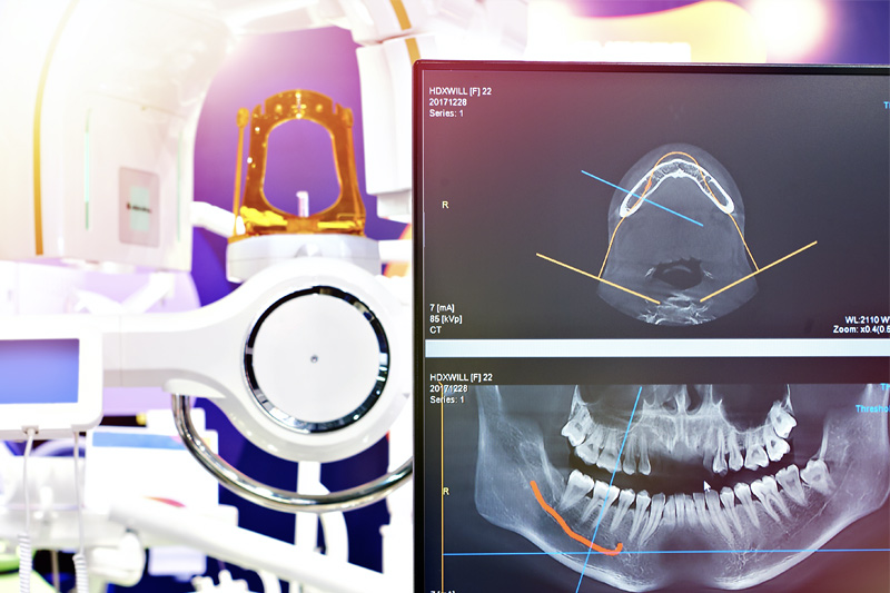 Digital X-Rays in Clarkston