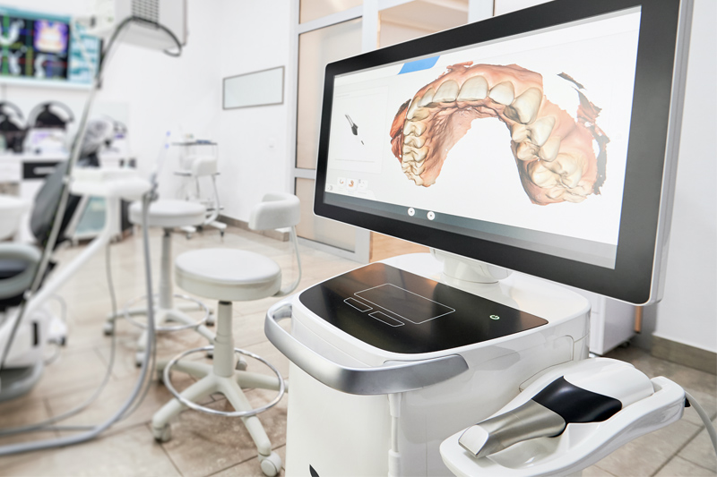 Intra-Oral Scanner in Clarkston